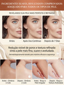 Gel Exfoliante Purificante Quarxery 2