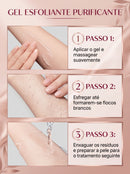 Gel Exfoliante Purificante Quarxery 2